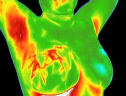 thermo scan