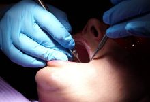 Dental Hygienist Teeth Cleaning